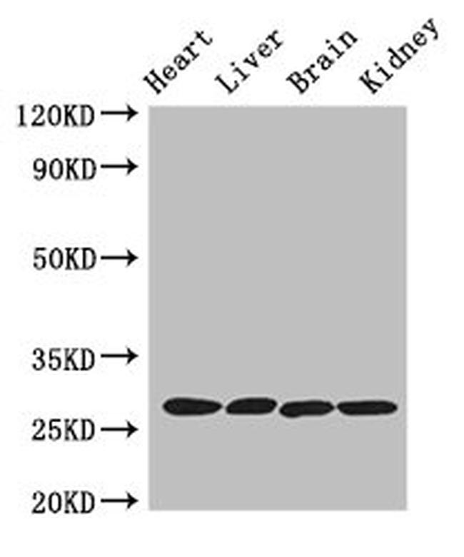 Trypsin 2 Antibody in Western Blot (WB)