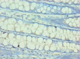 QARS Antibody in Immunohistochemistry (Paraffin) (IHC (P))