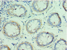 QARS Antibody in Immunohistochemistry (Paraffin) (IHC (P))