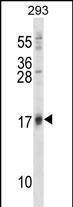 ISG15 Antibody in Western Blot (WB)