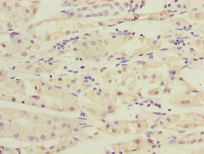 RAB4B Antibody in Immunohistochemistry (Paraffin) (IHC (P))