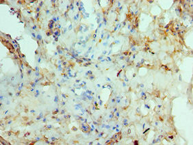 RAD51D Antibody in Immunohistochemistry (Paraffin) (IHC (P))