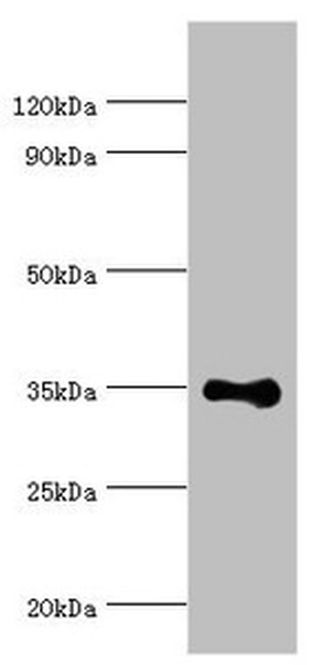 RAD51D Antibody in Western Blot (WB)