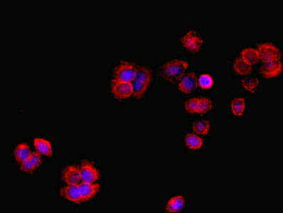 RCBTB2 Antibody in Immunocytochemistry (ICC/IF)