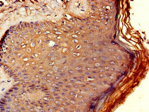 RCBTB2 Antibody in Immunohistochemistry (Paraffin) (IHC (P))