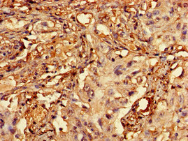 RCBTB2 Antibody in Immunohistochemistry (Paraffin) (IHC (P))