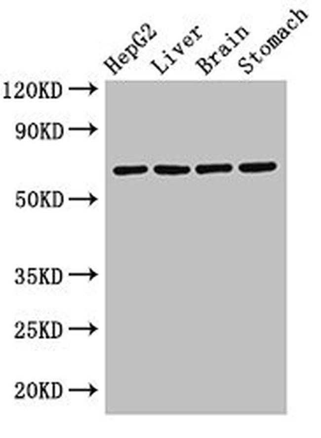 RCBTB2 Antibody in Western Blot (WB)