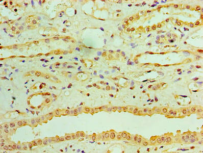 RDH11 Antibody in Immunohistochemistry (Paraffin) (IHC (P))