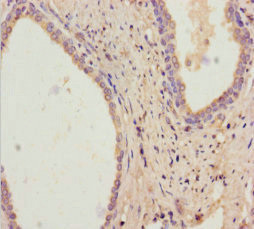 RDH11 Antibody in Immunohistochemistry (Paraffin) (IHC (P))