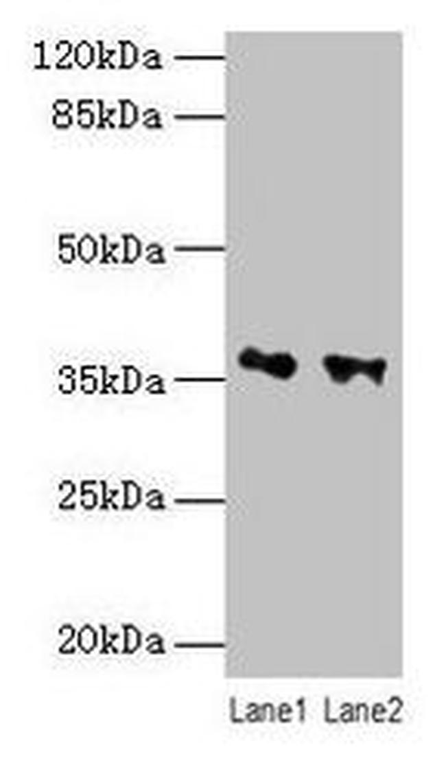 RDH11 Antibody in Western Blot (WB)