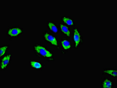 RGS20 Antibody in Immunocytochemistry (ICC/IF)