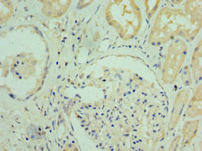 RGS20 Antibody in Immunohistochemistry (Paraffin) (IHC (P))