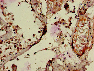 RNF126 Antibody in Immunohistochemistry (Paraffin) (IHC (P))