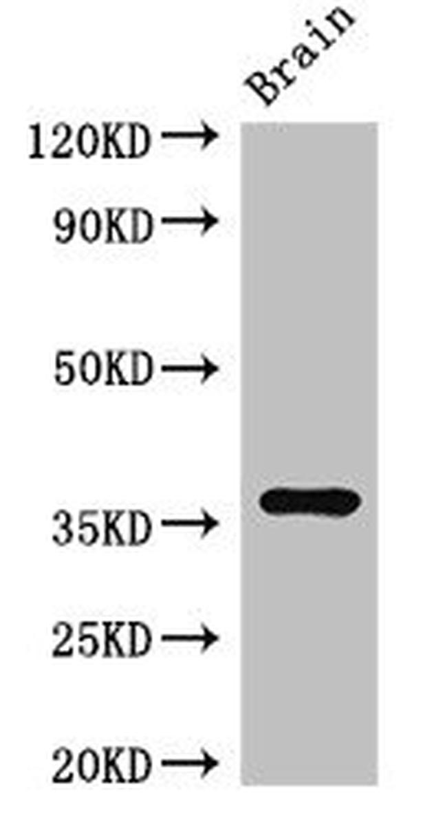 RNF126 Antibody in Western Blot (WB)