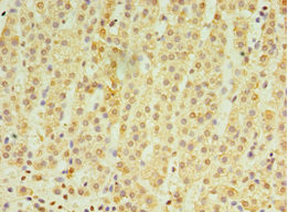 RNF212 Antibody in Immunohistochemistry (Paraffin) (IHC (P))