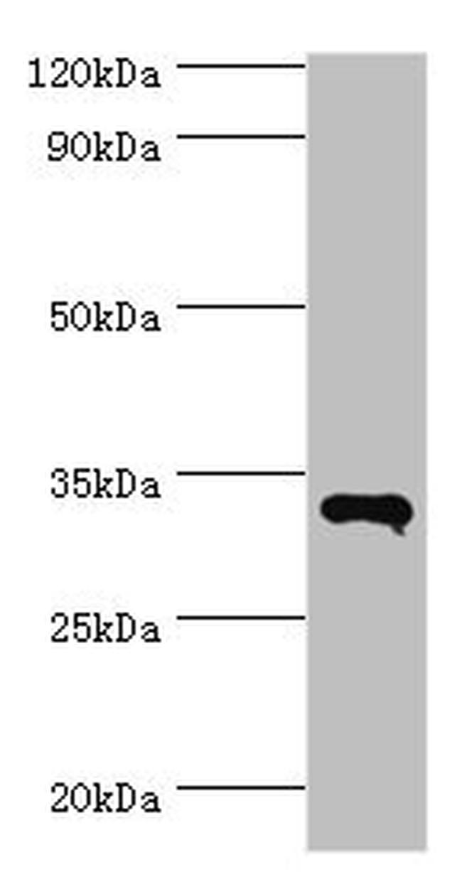 RNF212 Antibody in Western Blot (WB)