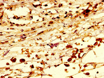 C13orf7 Antibody in Immunohistochemistry (Paraffin) (IHC (P))