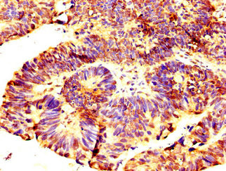 C13orf7 Antibody in Immunohistochemistry (Paraffin) (IHC (P))