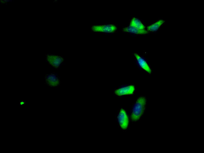 RPL19 Antibody in Immunocytochemistry (ICC/IF)