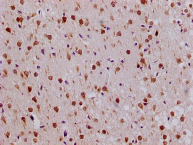 RPL19 Antibody in Immunohistochemistry (Paraffin) (IHC (P))