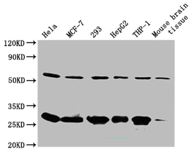 RPL19 Antibody in Western Blot (WB)