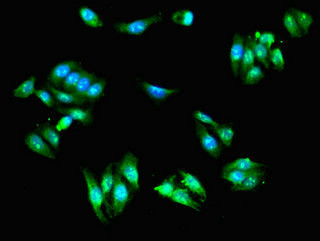 SCIN Antibody in Immunocytochemistry (ICC/IF)