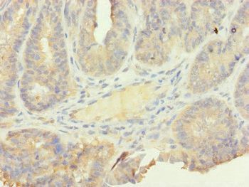 SFI1 Antibody in Immunohistochemistry (Paraffin) (IHC (P))