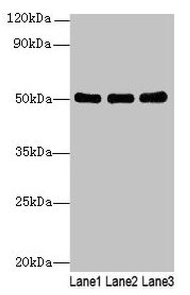 SIGLEC6 Antibody in Western Blot (WB)