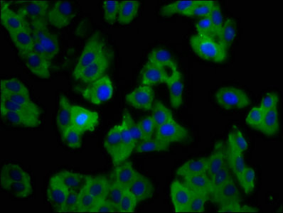 SLC11A1 Antibody in Immunocytochemistry (ICC/IF)