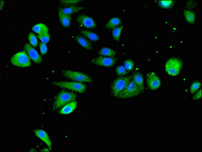 VMAT2 Antibody in Immunocytochemistry (ICC/IF)