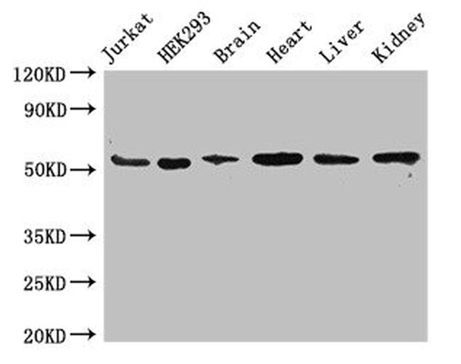 VMAT2 Antibody in Western Blot (WB)