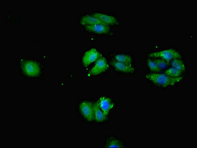 SLC1A7 Antibody in Immunocytochemistry (ICC/IF)