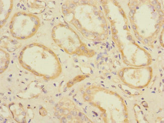 SLC1A7 Antibody in Immunohistochemistry (Paraffin) (IHC (P))