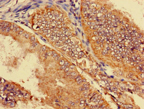 SLC22A2 Antibody in Immunohistochemistry (Paraffin) (IHC (P))