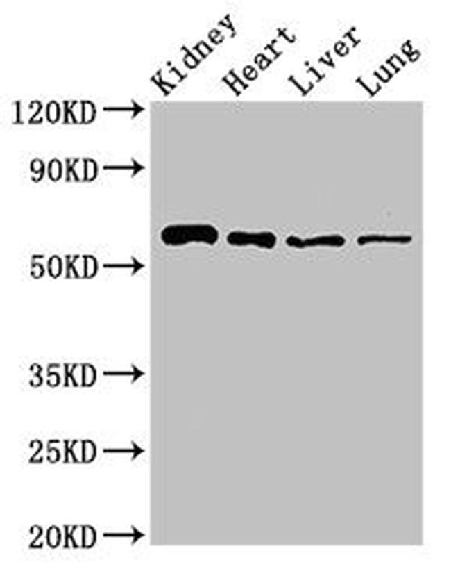 SLC22A2 Antibody in Western Blot (WB)