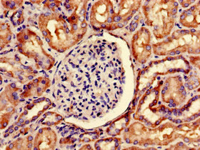 SNRPD1 Antibody in Immunohistochemistry (Paraffin) (IHC (P))