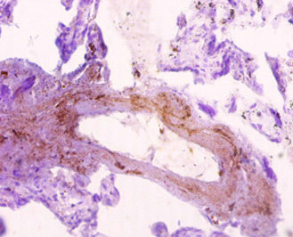 SNX20 Antibody in Immunohistochemistry (Paraffin) (IHC (P))