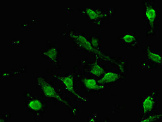 SOX9 Antibody in Immunocytochemistry (ICC/IF)