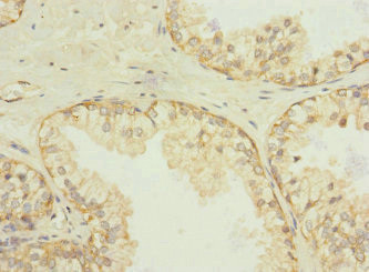 SQRDL Antibody in Immunohistochemistry (Paraffin) (IHC (P))