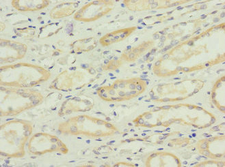 SQRDL Antibody in Immunohistochemistry (Paraffin) (IHC (P))