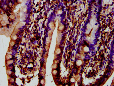 Synaptojanin 1 Antibody in Immunohistochemistry (Paraffin) (IHC (P))