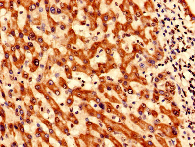 SYNJ2BP Antibody in Immunohistochemistry (Paraffin) (IHC (P))