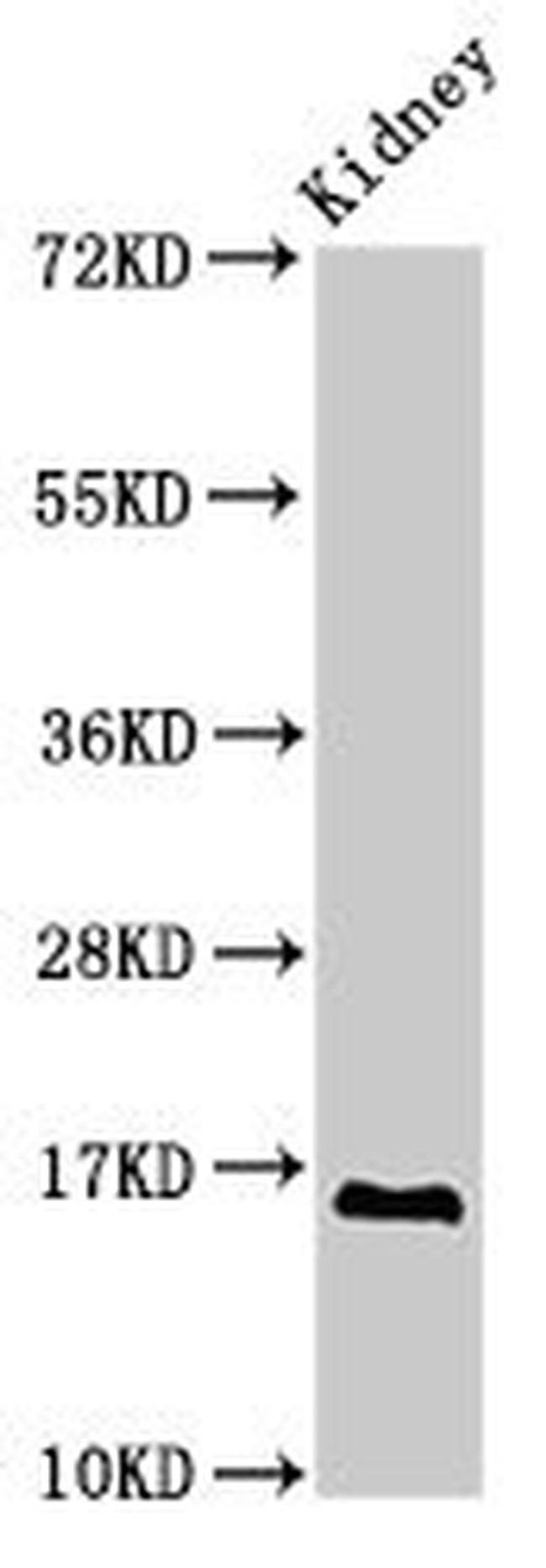 SYNJ2BP Antibody in Western Blot (WB)