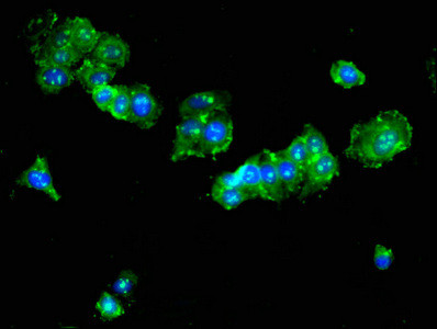 TAT Antibody in Immunocytochemistry (ICC/IF)