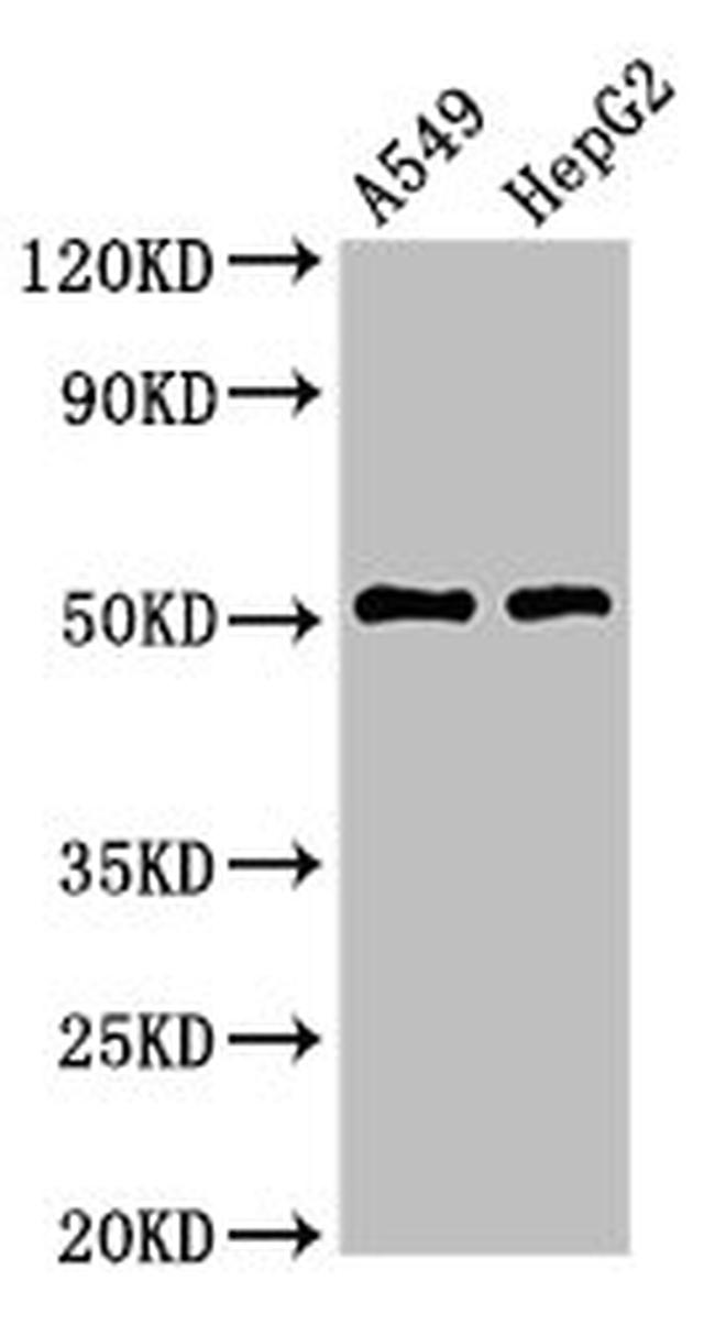 TAT Antibody in Western Blot (WB)