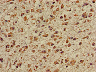 TGDS Antibody in Immunohistochemistry (Paraffin) (IHC (P))