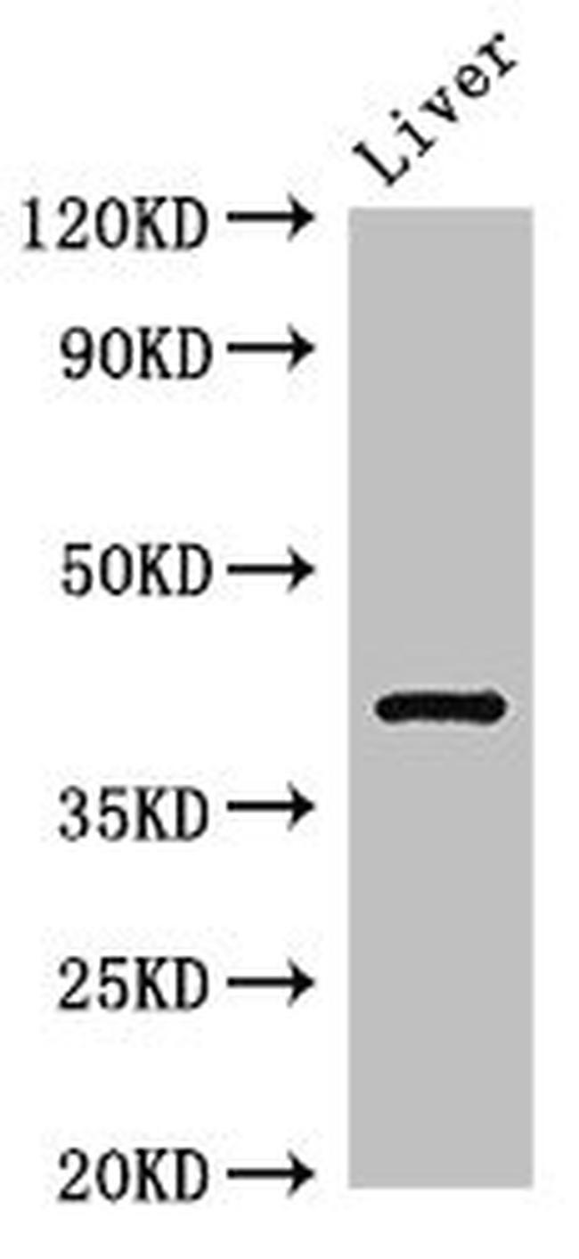 TGDS Antibody in Western Blot (WB)