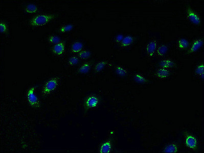 TMEM165 Antibody in Immunocytochemistry (ICC/IF)