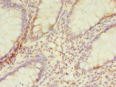 TMEM165 Antibody in Immunohistochemistry (Paraffin) (IHC (P))