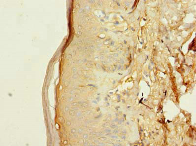 T176B Antibody in Immunohistochemistry (Paraffin) (IHC (P))